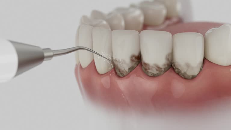 Trusted Teeth Cleaning And Checkup service in Surfside Beach, SC - Dentist Open Now